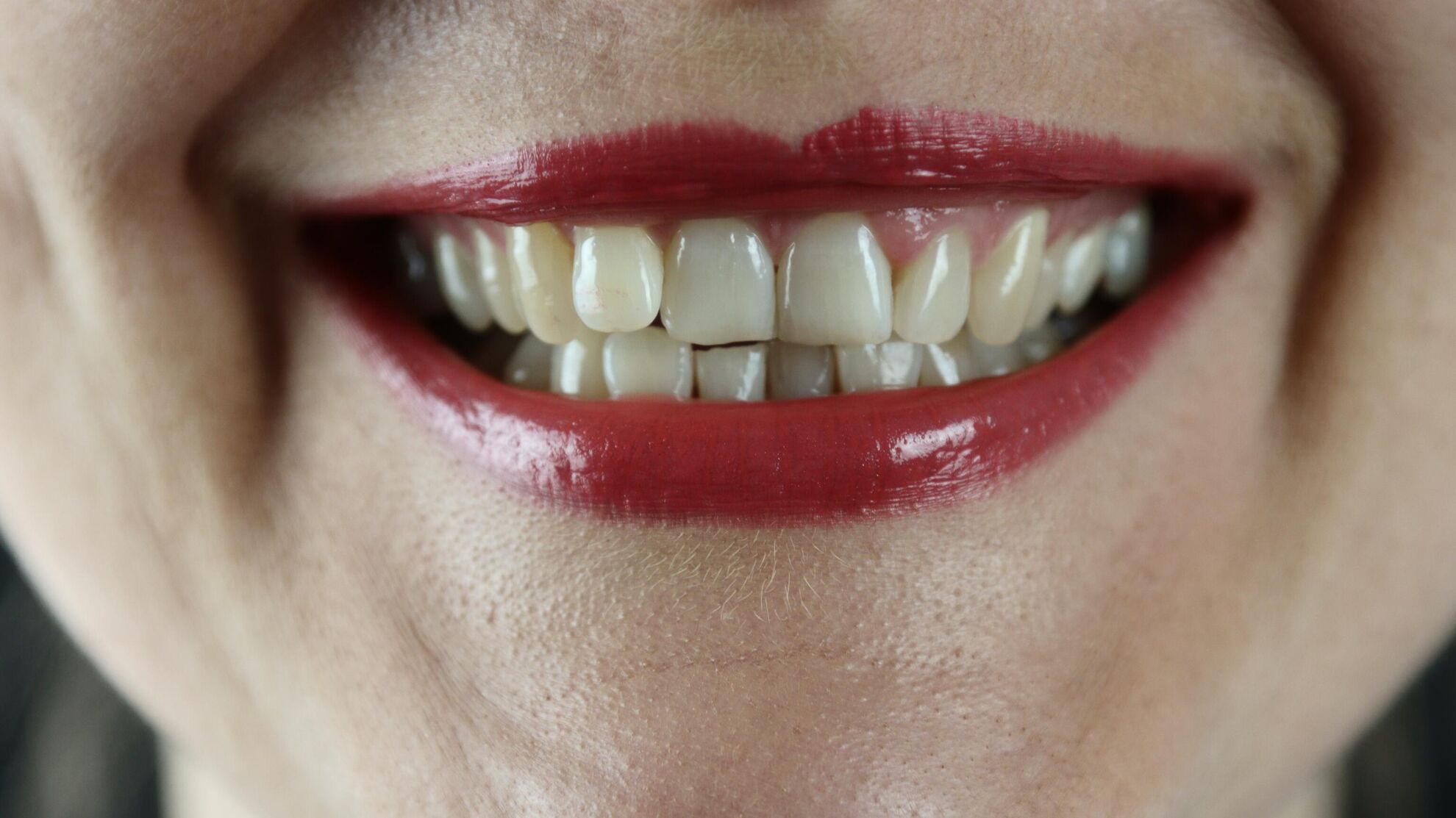 Правда ли, что курение вейпа портит зубы: объясняет стоматолог - News-hub.ru, 30.10.2023